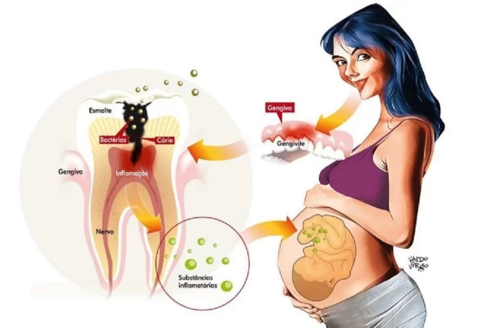 De Bem com a Vida: O pré-natal odontológico, grávidas precisam reforçar os  cuidados bucais. | ASMETRO-SI